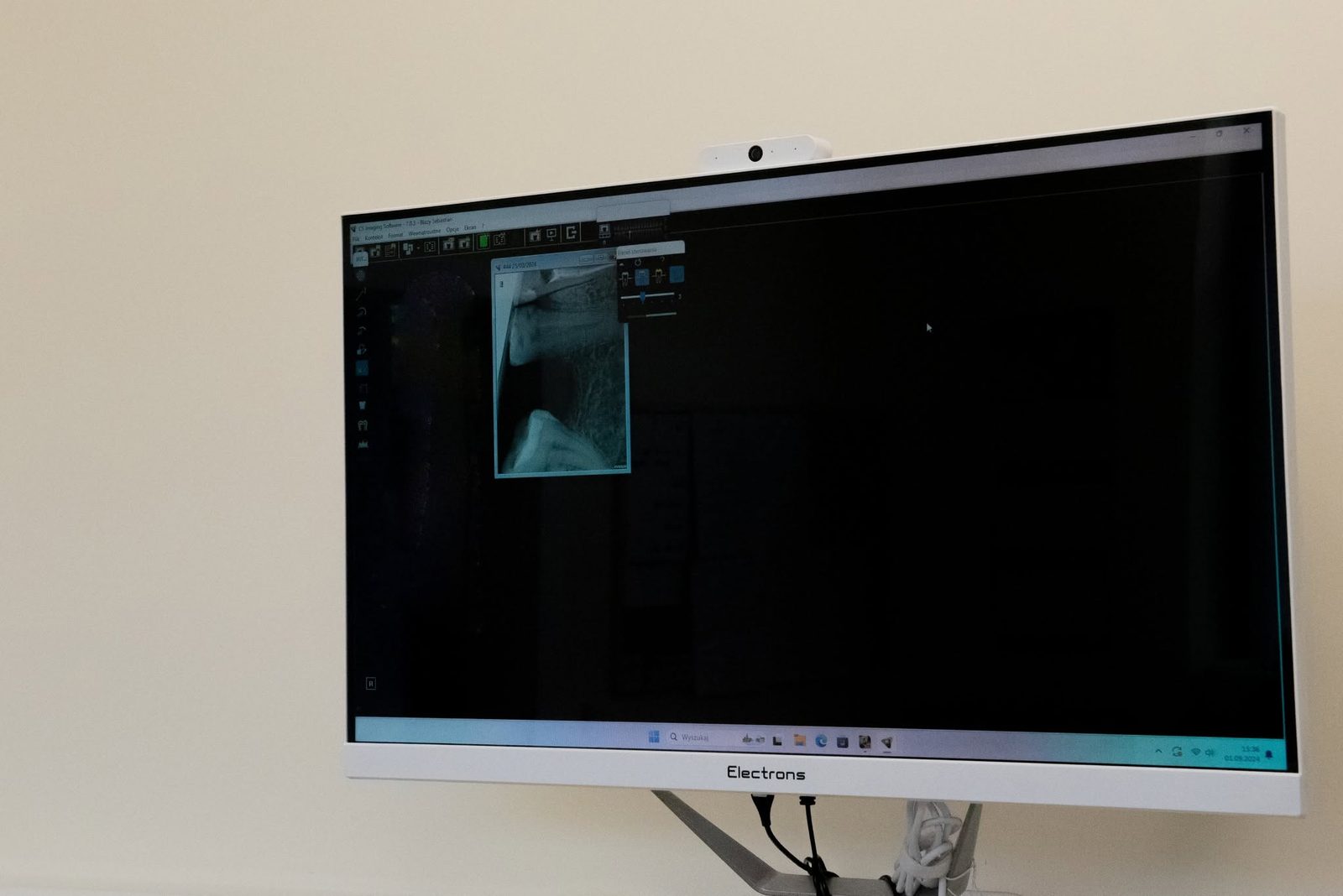 Monitor w gabinecie stomatologicznym